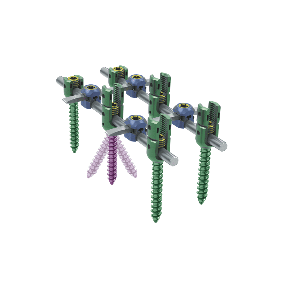 KSS-I 6.0 Spinal Fixation System - Torx