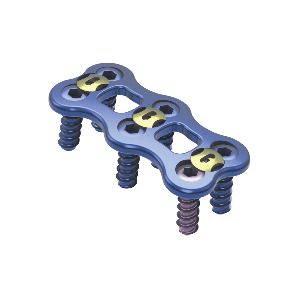 Prodorth Cervical PEEK Cage - Bladed