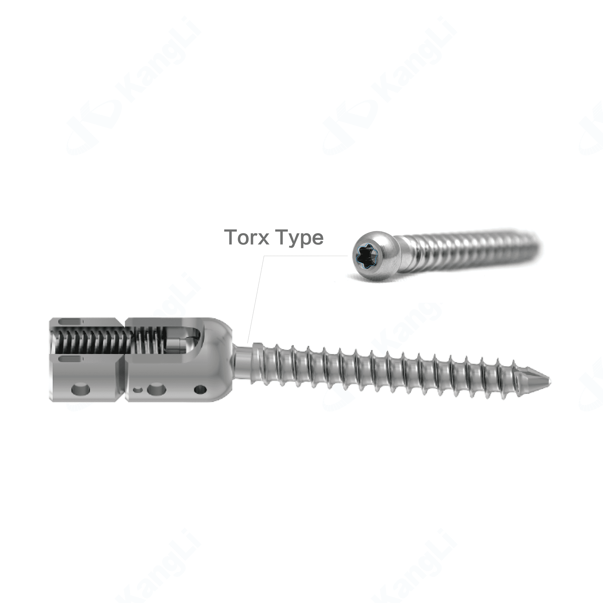 KSS-I 6.0 Spinal Fixation System - Torx – Image 5