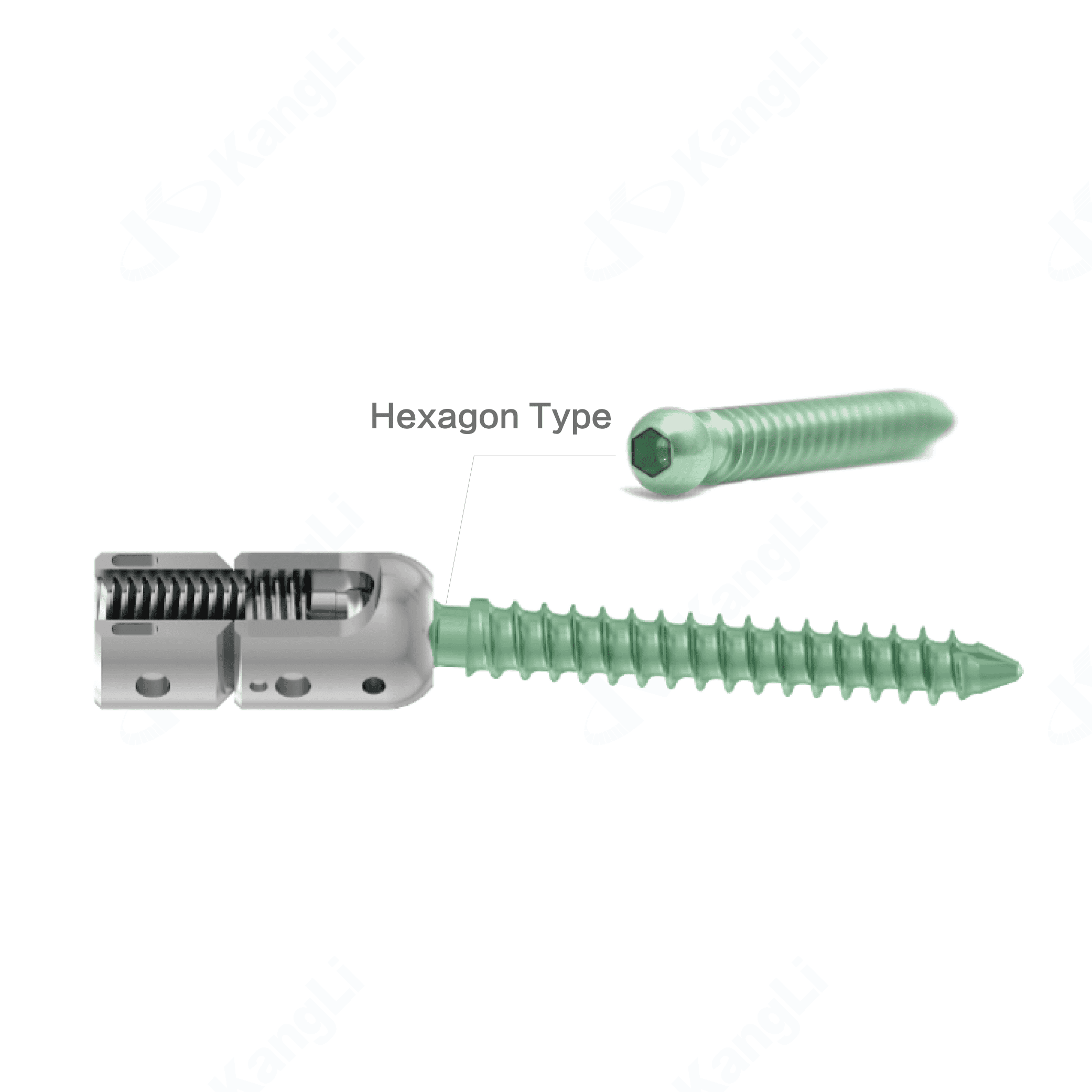 KSS-I 6.0 Spinal Fixation System - Torx – Image 4